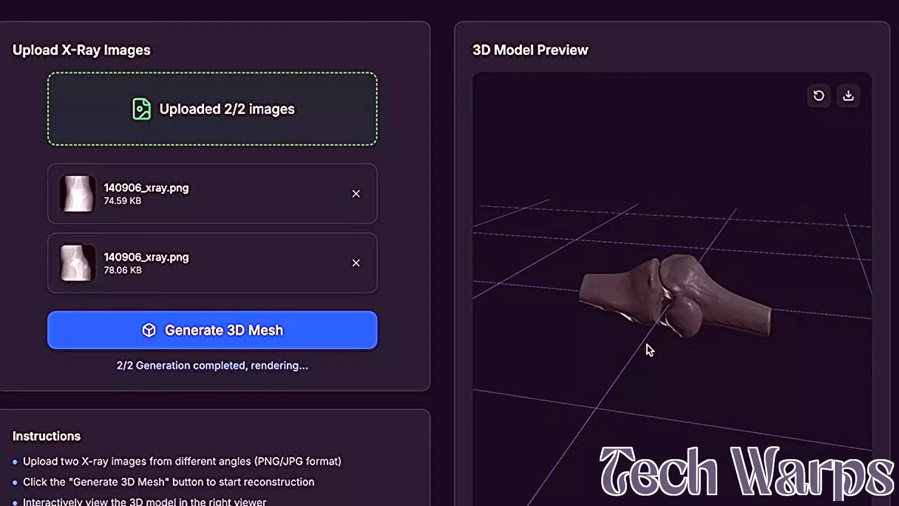Revolutionary AI Technology Dramatically Reduces Radiation Exposure in Medical Imaging