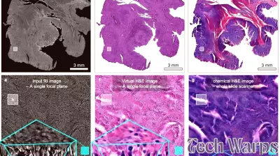 Breakthrough in Cancer Research: Non-Invasive 3D Virtual Staining Technology