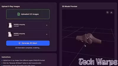 Revolutionary AI Technology Dramatically Reduces Radiation Exposure in Medical Imaging